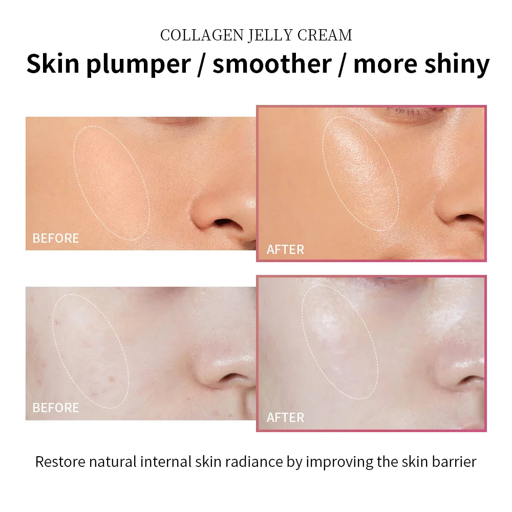 Lakerain Anti Aging Collagen Jelly Cream With Niacinamide Moisturizer by S And B Enterprise