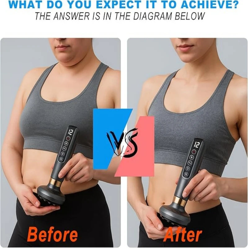 Back Vacuum Cupping Massager With USB Power And 12 Levels by S And B Enterprise