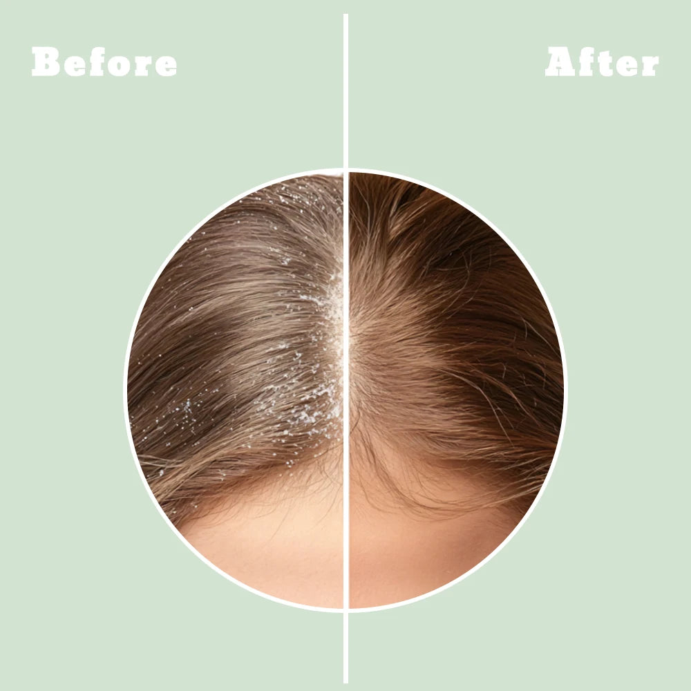 ALFHEIM Rosemary Purifying Haircare Set Shampoo And Conditioner