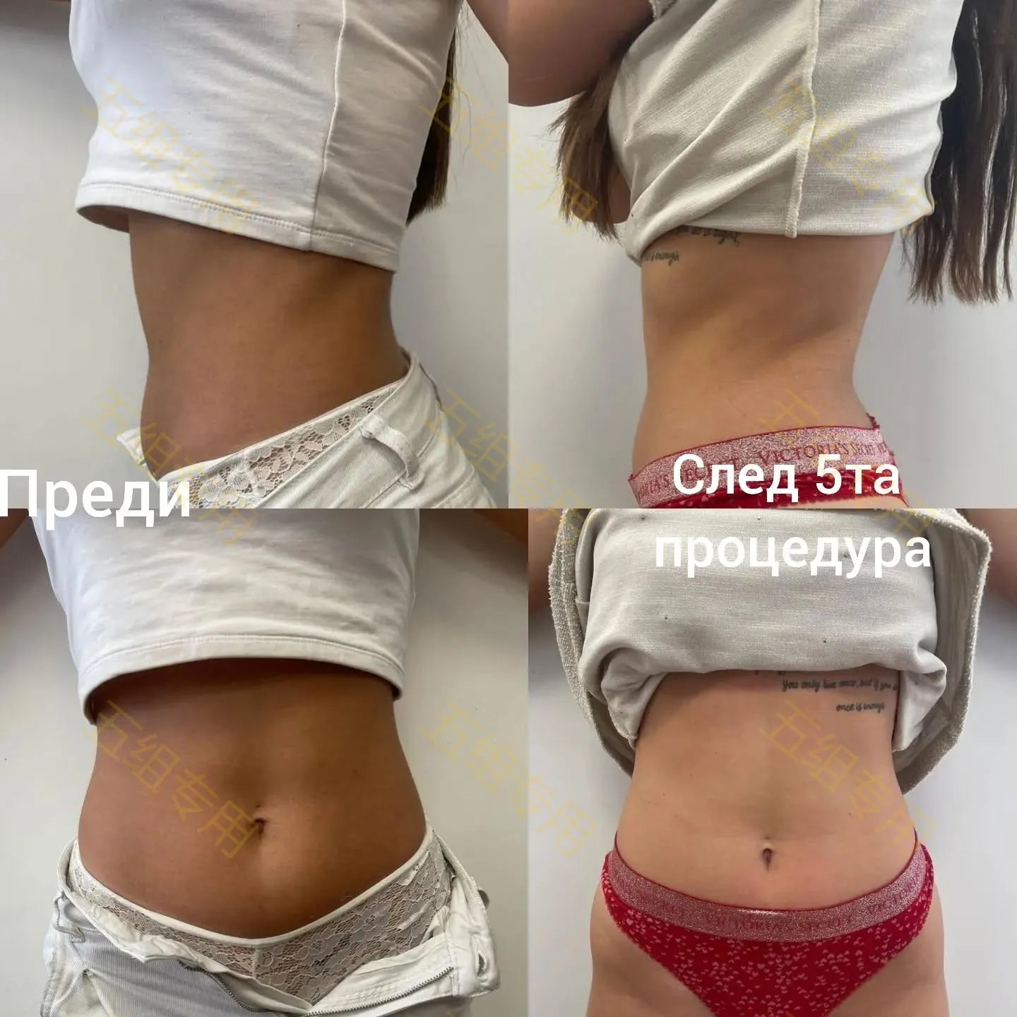 MYOSLIM Neo EMS Body Sculpting Machine RF Professional Medical Grade
