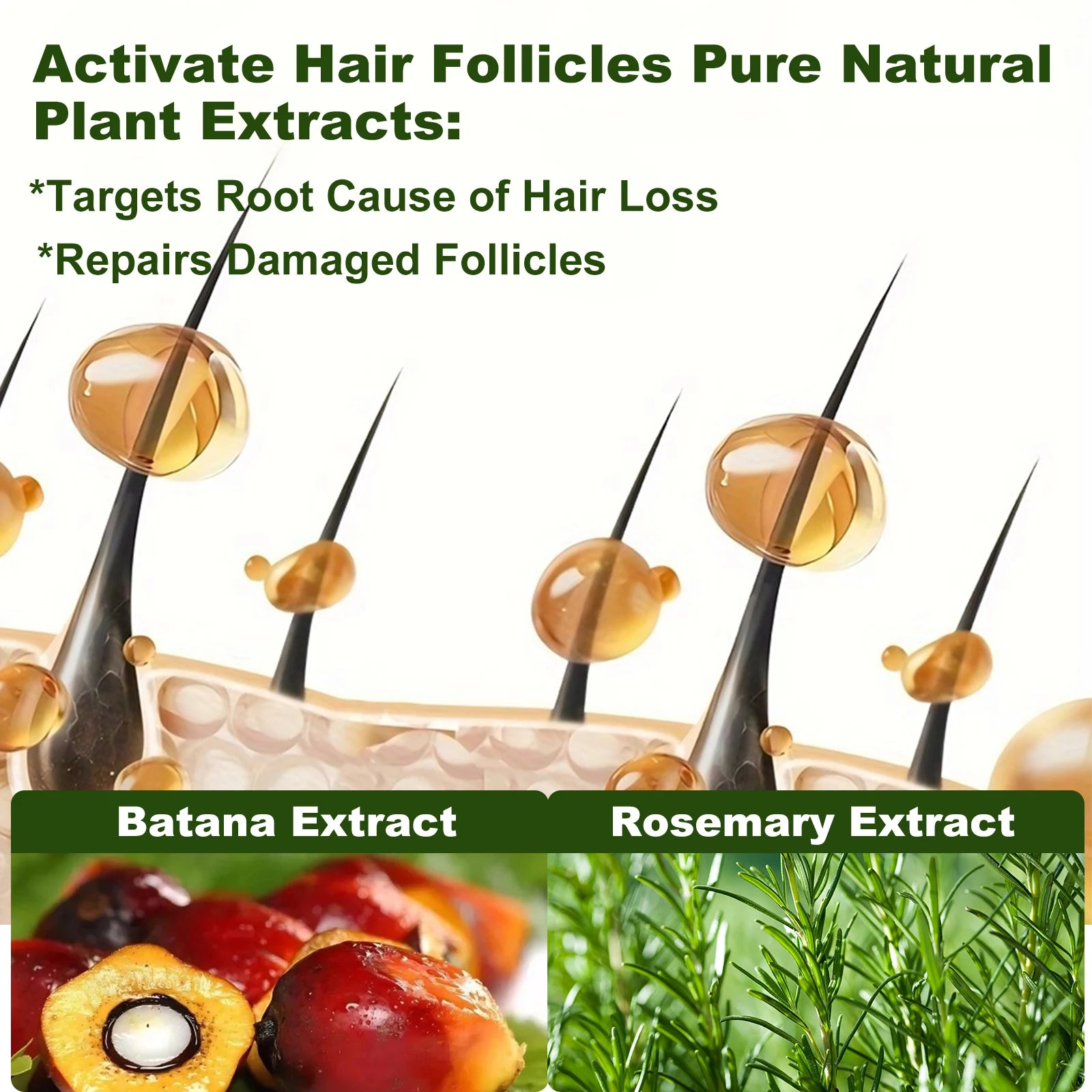 Tgideas Rosemary Batana Oil Shampoo For Hair Growth And Strength by S And B Enterprise