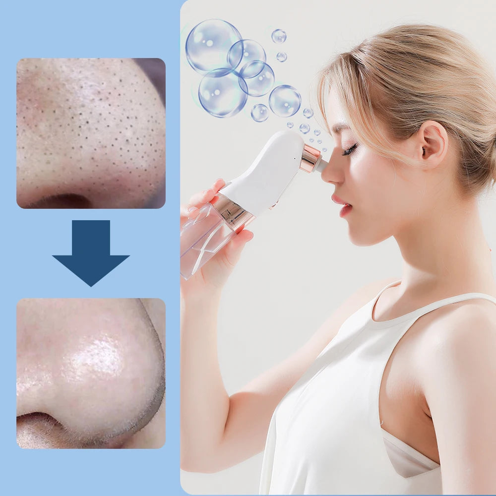 Electric Blackhead Remover Vacuum Suction Pore Cleaner