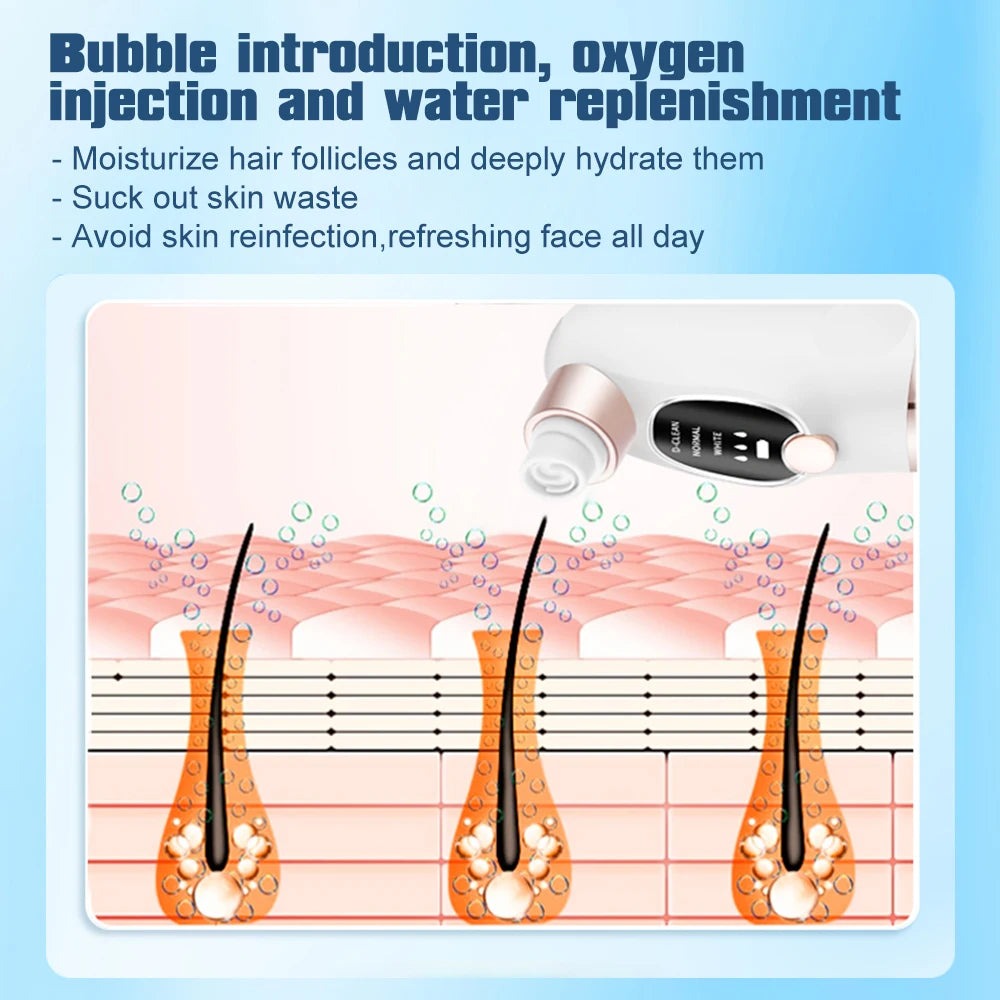 Electric Blackhead Remover Vacuum Suction Pore Cleaner