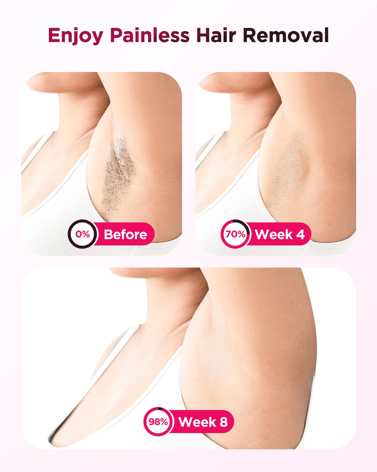 IPL hair removal device by S And B Enterprise; armpit before/after collage on pink background
