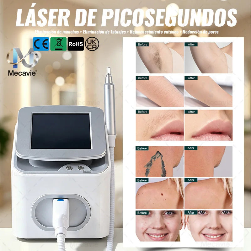 Portable Pico Picosecond Q-Switch Nd:YAG laser beauty machine by Mecavie, white with touchscreen for salon/home use