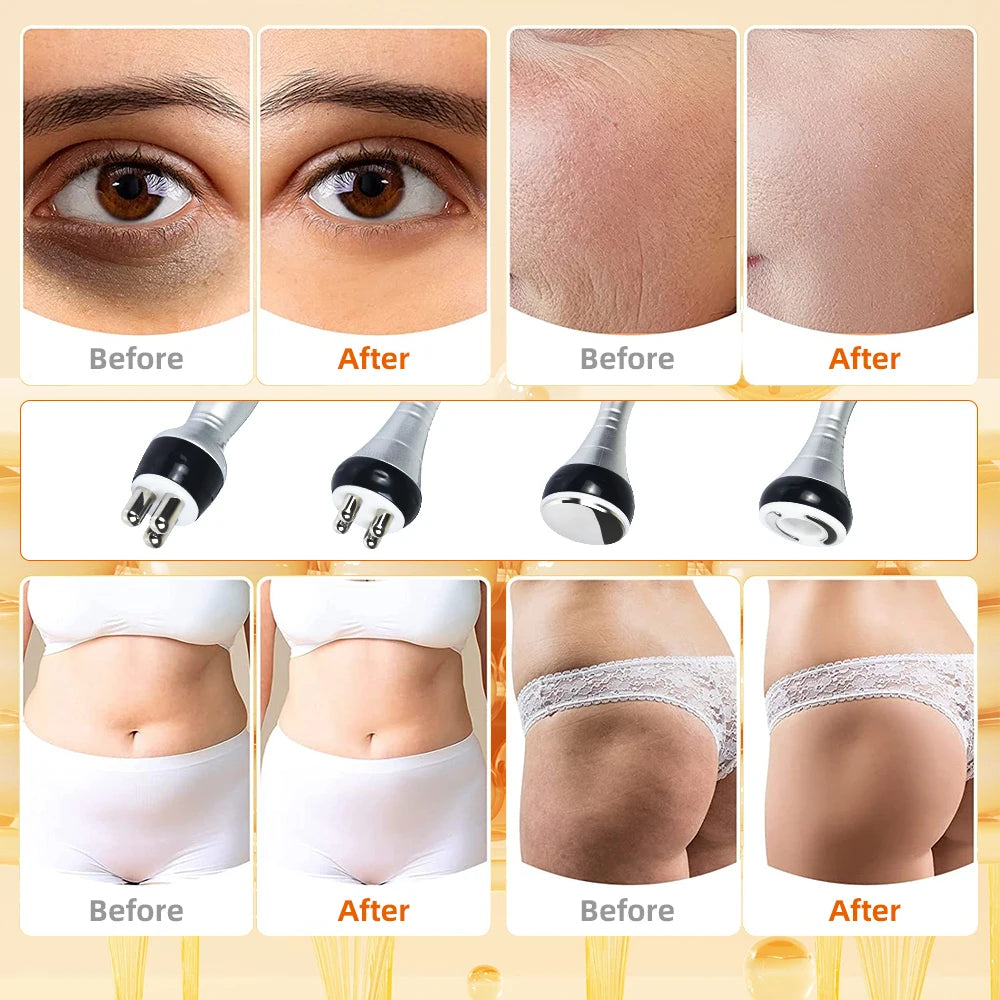4 in 1 40K cavitation ultrasonic body slimming machine by S And B Enterprise with vacuum suction heads